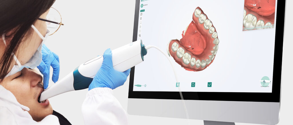 Intraoral Scanning Enhances Patient Education, Diagnosis, and Treatment