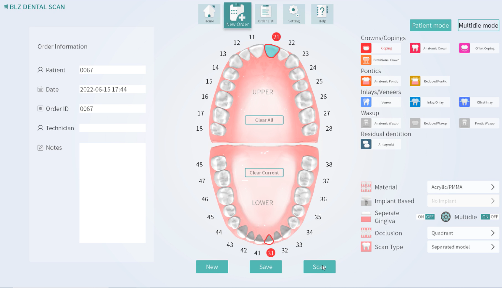 Intraoral Scanning Impressions VS. Traditional Impressions