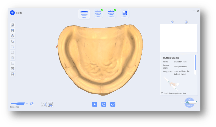 scan edentulous model