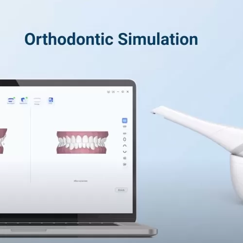 Intraoral Scanner Orthodontic Simulation