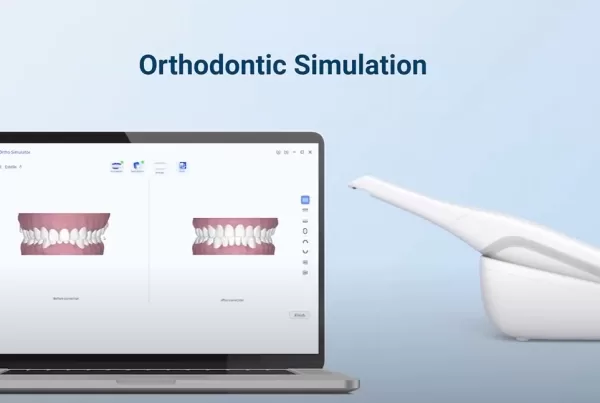 Intraoral Scanner Orthodontic Simulation