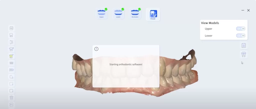 Intraoral scanner orthodontic simulation