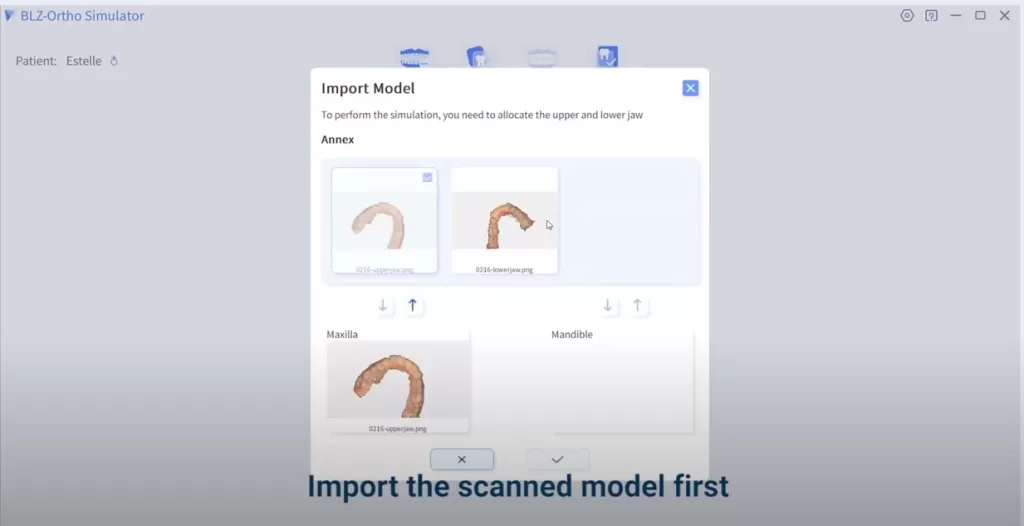 Intraoral scanner orthodontic simulation import scanned model