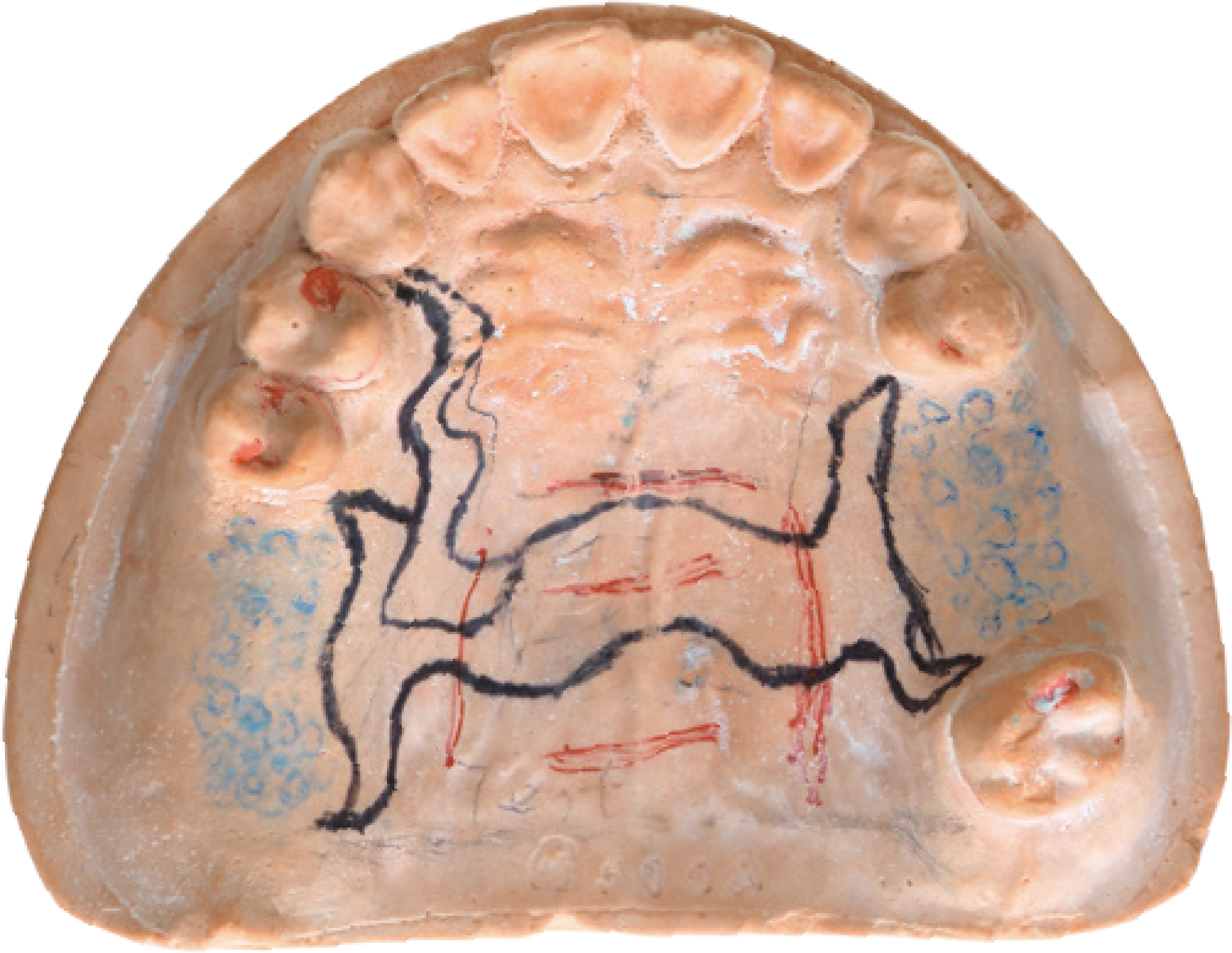 BLZ Dental Lab Scanner LS200 - 17